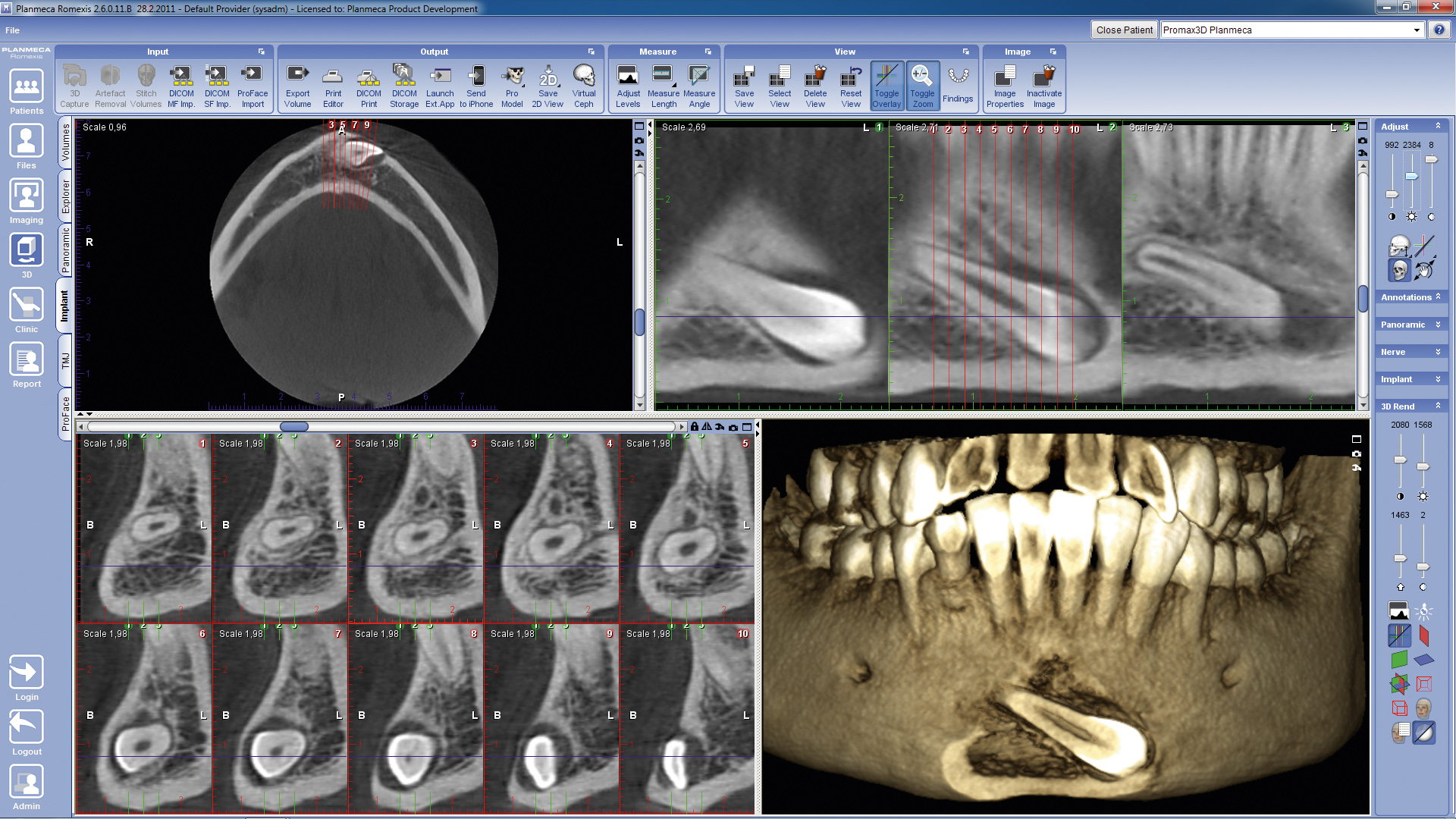 romexis images